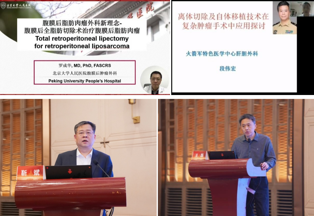 山东省医学会第四次腹膜后肿瘤多学科学术会议在济南召开